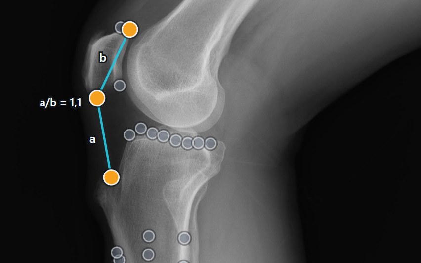 Lateral knee radiograph with the landmarks and the construction of the Insall-Salvati index